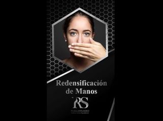 Rejuvenecimiento de manos - Dr. Raúl Sierra Franco