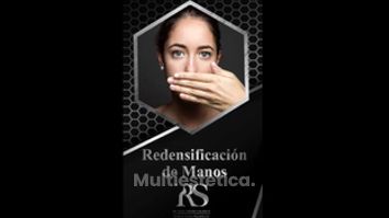 Rejuvenecimiento de manos - Dr. Raúl Sierra Franco