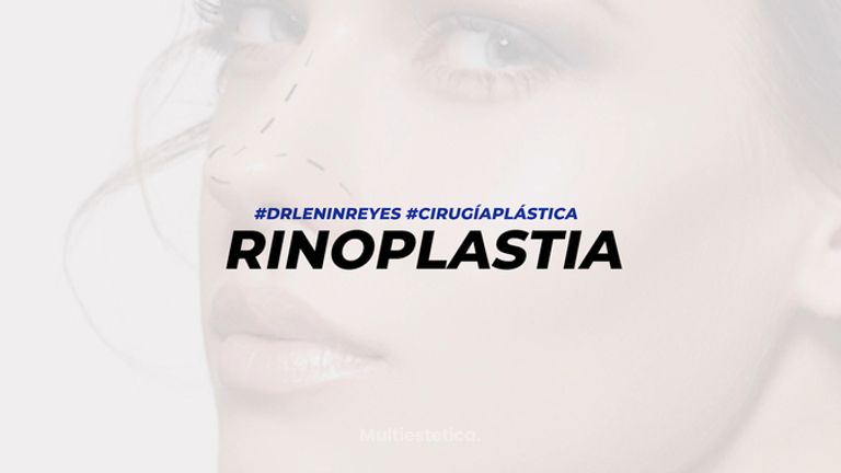 Testimonio rinoplastia