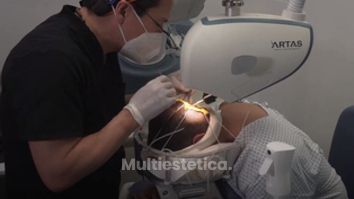 TRASPLANTE CAPILAR, CON ROBOT ARTAS, DR ALEJANDRO MÉNDEZ SASHIDA, LEÓN GTO, MÉXICO. 1080p