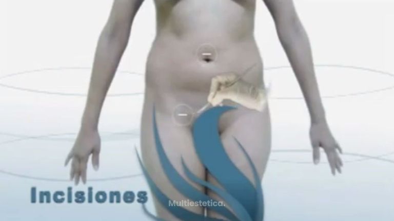 Consigue la figura que deseas