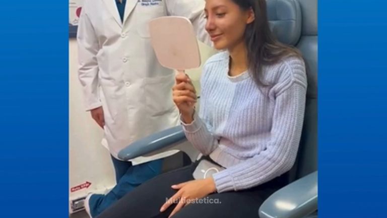 Testimonio Rinoplastia -Dr. Sergio Guillermo Ramírez Ledesma