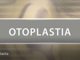 Otoplastia