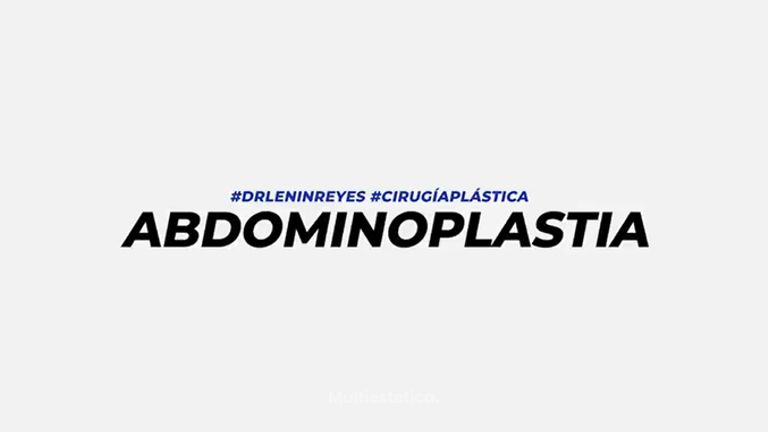 Abdominoplastia 