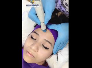 Hydra Facial