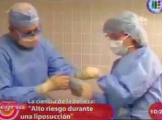 Lo que debes saber sobre las infecciones en la liposucción