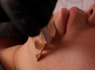 Hydrafacial - MEILi Rejuvenecimiento