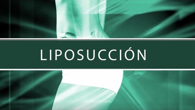 Dr. Sergio Quiroz Zarate - Liposucción