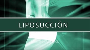 Dr. Sergio Quiroz Zarate - Liposucción