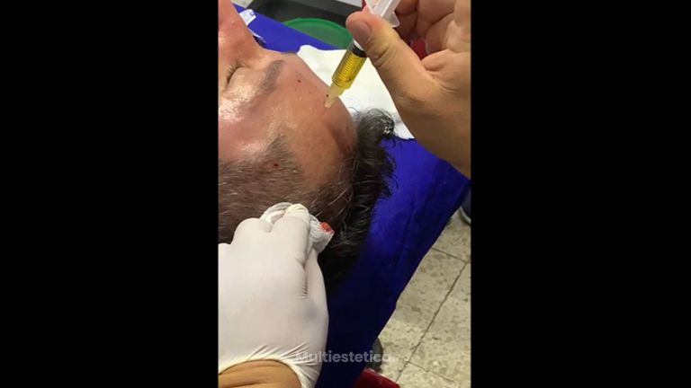 PRP - Dr. Jesús Omar Carreón Terrones