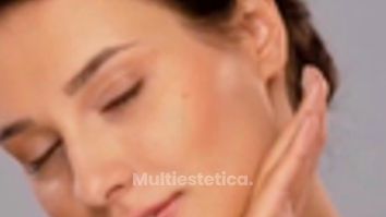 Tratamiento Facial Sculptra - Moskalia