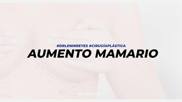 Aumento mamario - Dr. Lenin Alfonso Reyes Ibarra