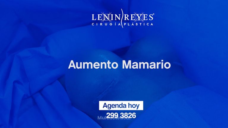 Aumento mamario