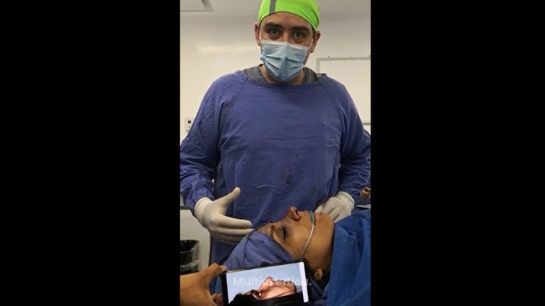 Rinoplastia - Dr. Daniel Ponce Franco