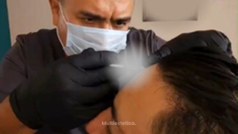 Toxina Botulínica - Dr. Andrés Raúl Cortés Ponce