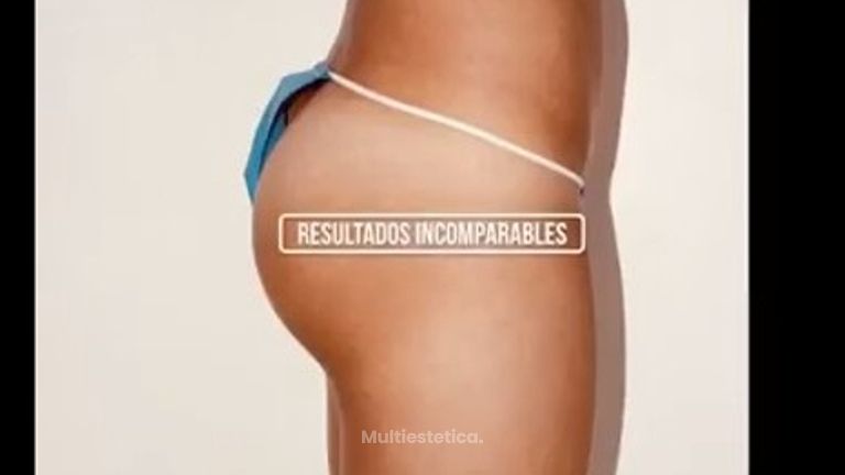 Implantes glúteos México