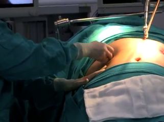 Soluciona tu problema de obesidad de manera eficaz