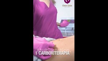 Carboxiterapia