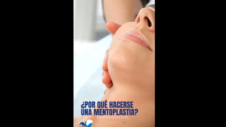 Mentoplastia - Dr. Mario Alonso Flores Saldivar