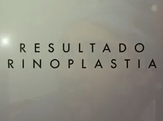 Testimonio rinoplastia