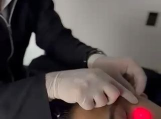Endolift Facial - SkinGama by Dr. Jorge Juan Herrera
