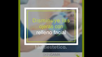 Eliminación de las ojeras - Skin Gama