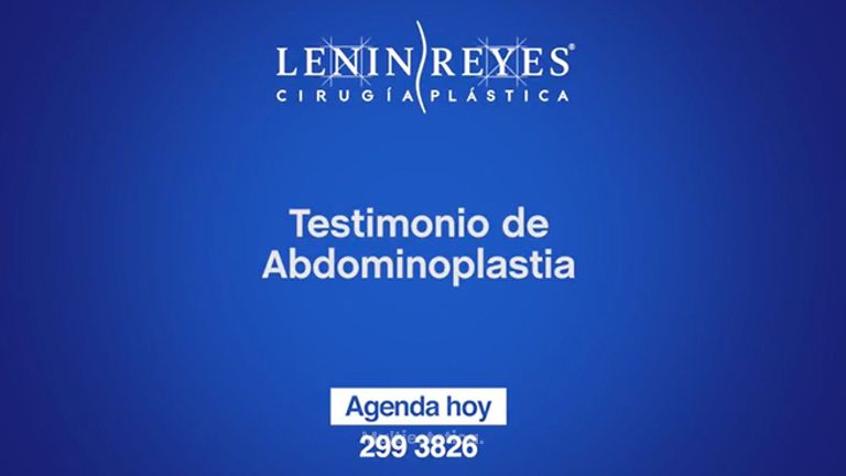 Testimonio de abdominoplastia