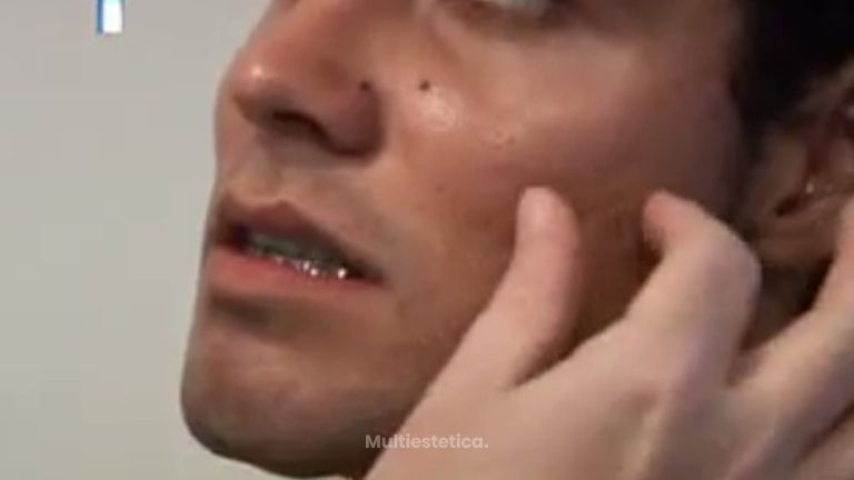 Elimina las imperfecciones de tu piel