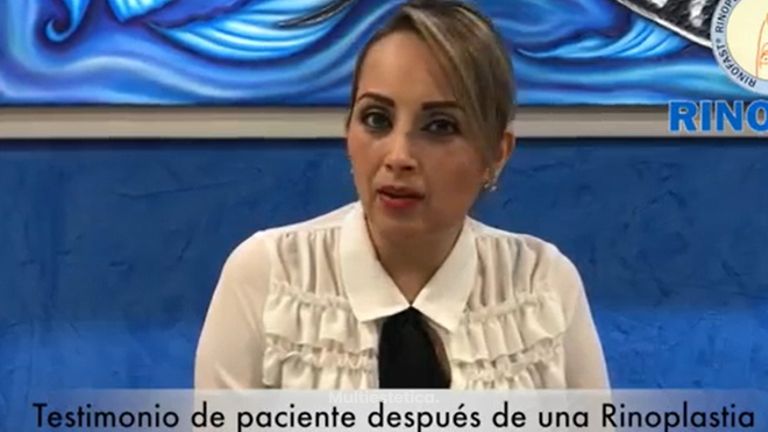 Testimonio rinoplastia