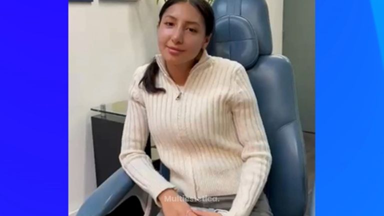 Testimonio Rinoplastia - Dr. Sergio Guillermo Ramírez Ledesma