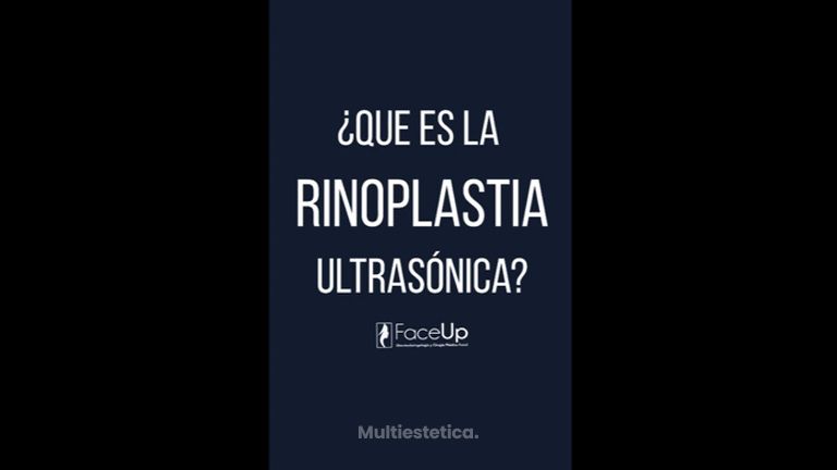 Rinoplastia ultrasónica - Face Up Puebla Dr. Víctor Hugo Nava Dominguez