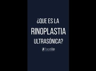 Rinoplastia ultrasónica - Face Up Puebla Dr. Víctor Hugo Nava Dominguez