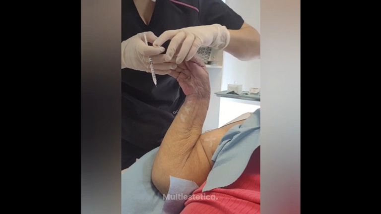 Toxina Botulínica - Clínica Heal Aesthetics