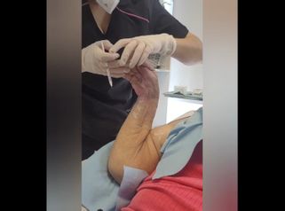 Toxina Botulínica - Clínica Heal Aesthetics