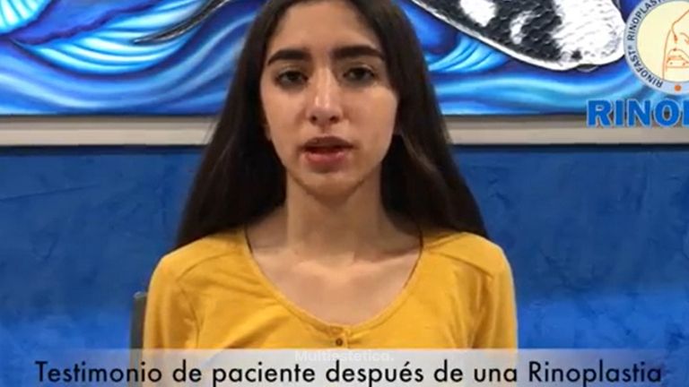 Testimonio rinoplastia