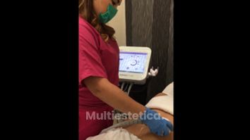 Radio Frecuencioa Freccionada