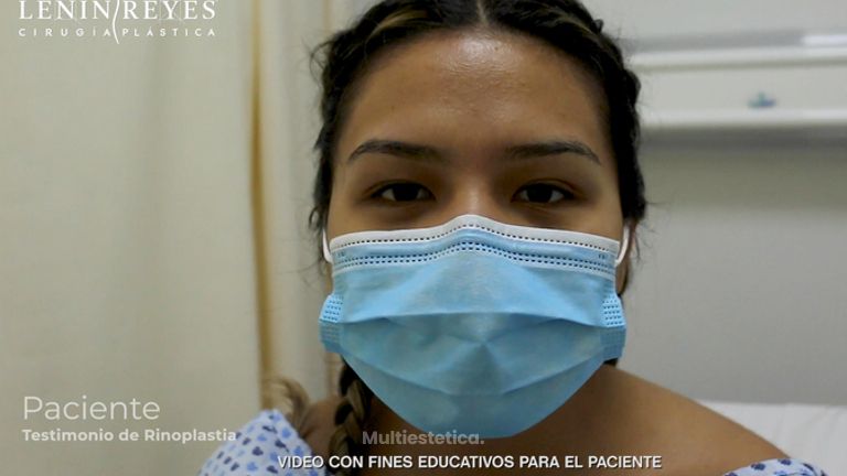 Rinoplastia - Dr. Lenin Alfonso Reyes Ibarra