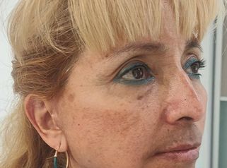 Lifting - Dr. Alejandro Cruz Segura