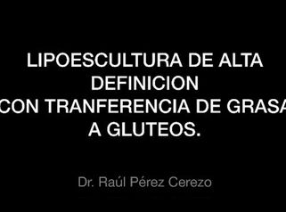 LIPOESCULTURA ALTA DEFINICION CON TRANSFERENCIA DE GRASA A GLUTEOS