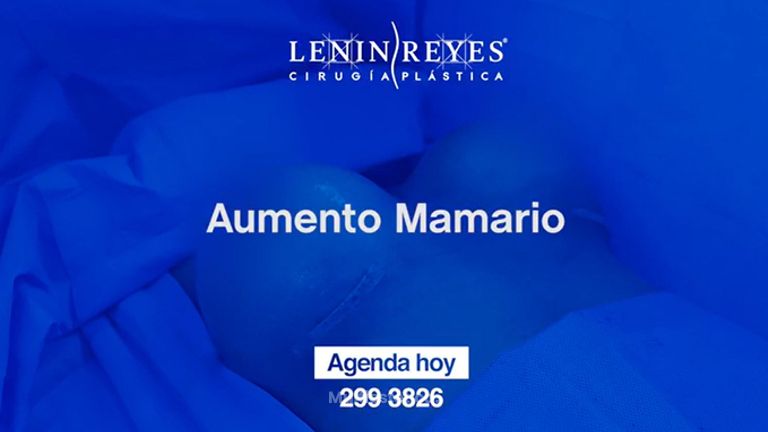 Aumento mamario