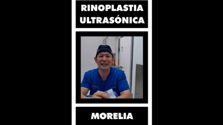 Rinoplastia - Dr. Lenin Alfonso Reyes Ibarra
