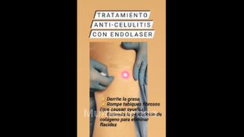 Celulitis - Clínica Heal Aesthetics