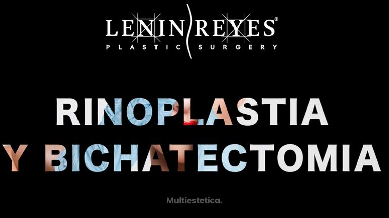 Rinoplastia + Bichectomía - Dr. Lenin Alfonso Reyes Ibarra