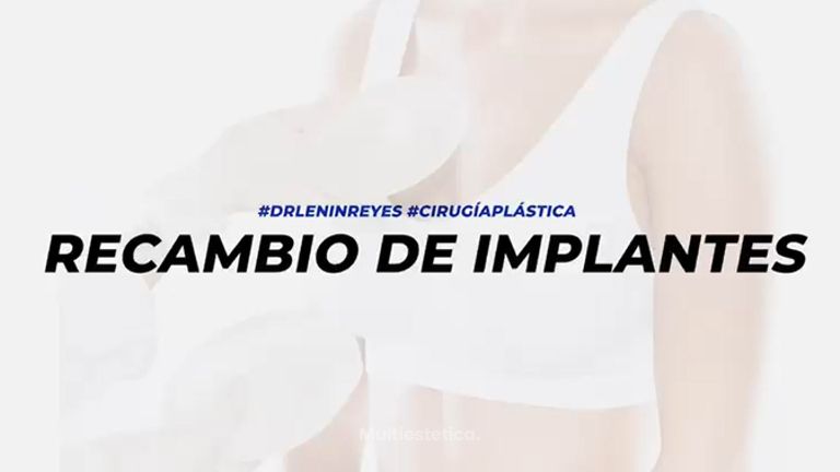 Recambio de implantes