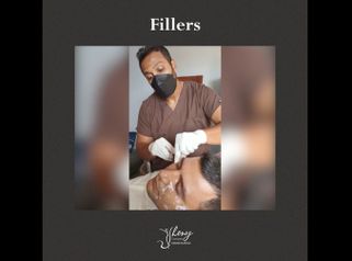 Fillers - Dr. Jhony Camarero