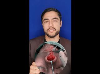 Rinoplastia - Dr. Gerardo Muñoz Jiménez