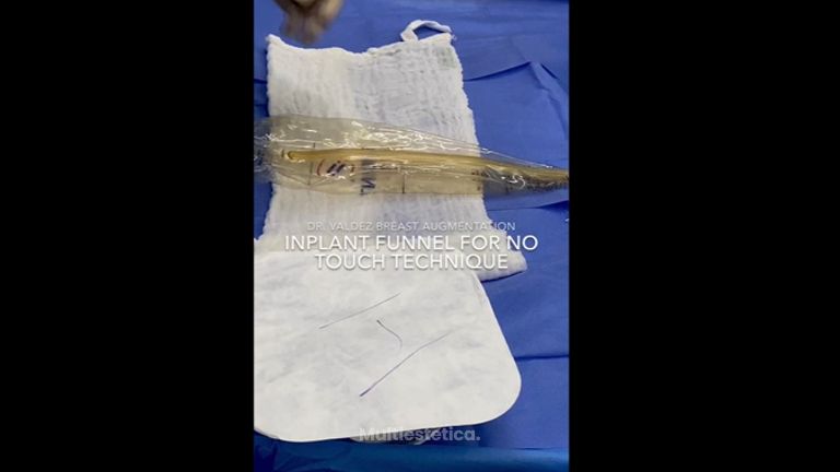 Implant funnel for no touch technique - Dr. Arturo Valdez
